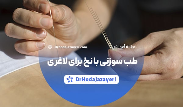 طب سوزنی با نخ برای لاغری
