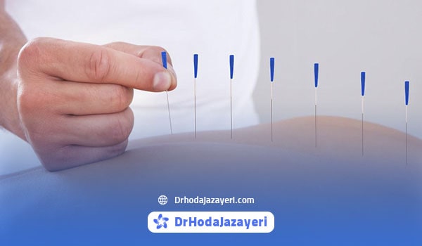 طب سوزنی با نخ