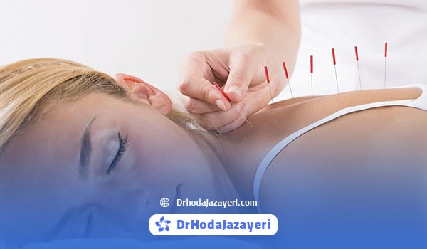 چطور با طب سوزنی لاغر شویم