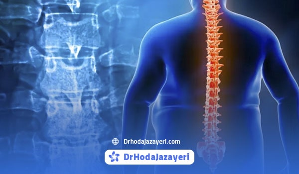 اضافه وزن و چاقی از علل دیسک کمر