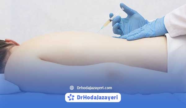 تزریق پی آر پی برای درمان دیسک کمر