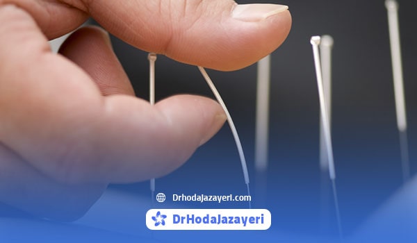 عوارض جانبی طب سوزنی برای دیسک کمر