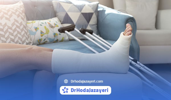 شکستگی آسان استخوان ها از علائم پوکی استخوان