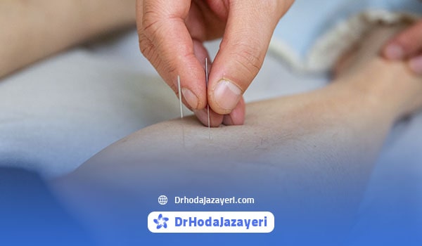سن مناسب افزایش قد با طب سوزنی