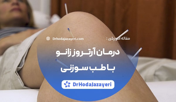 طب سوزنی برای آرتروز زانو