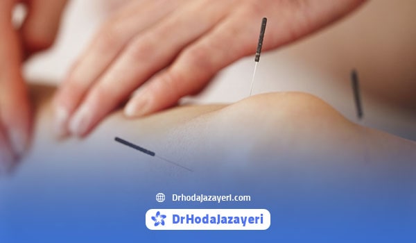 طب سوزنی زانو چیست