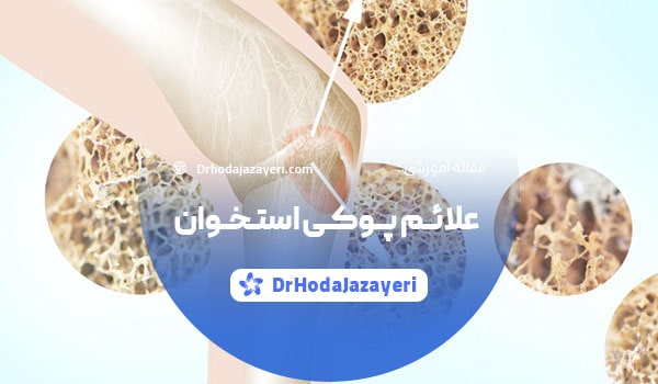 علائم و نشانه های پوکی استخوان