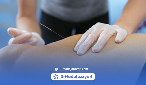 متخصص طب سوزنی برای آرتروز زانو