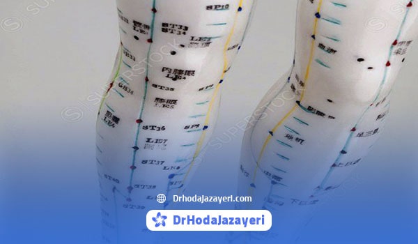 نقاط طب سوزنی برای آرتروز زانو