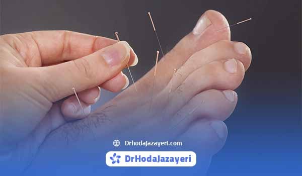 نقاط طب سوزنی برای افزایش قد