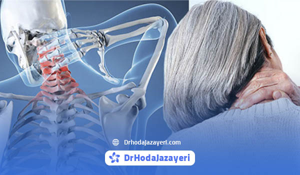Signs and symptoms of neck arthritis