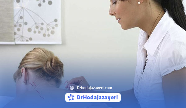 Benefits of acupuncture for neck arthritis