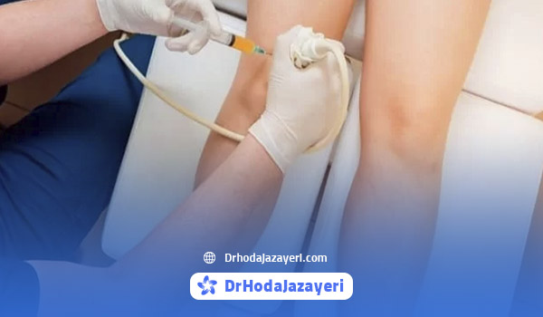 Ozone therapy for the treatment of knee arthritis without surgery