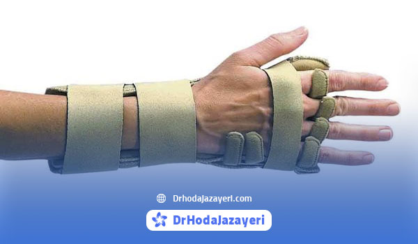 بریس طبی برای آرتروز دست و انگشتان