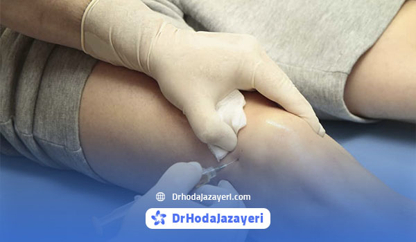 اقدامات قبل و بعد از تزریق پی آر پی برای آرتروز زانو