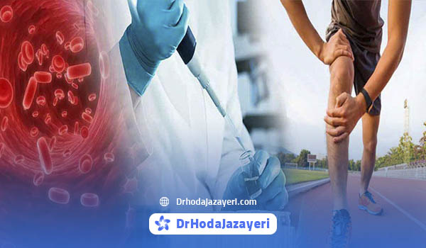 عوارض تزریق پی آر پی برای ارتروز زانو