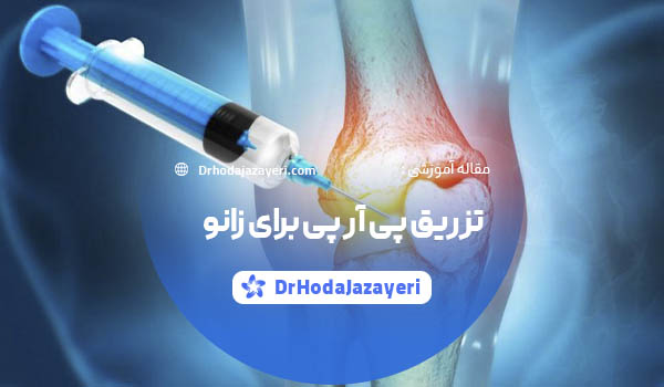 تزریق پی آر پی برای آرتروز زانو