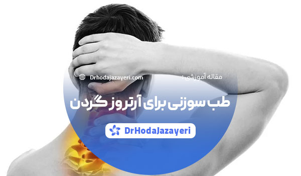 طب سوزنی برای آرتروز گردن