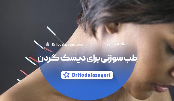 طب سوزنی برای دیسک گردن