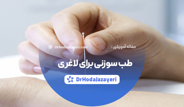 طب سوزنی برای لاغری