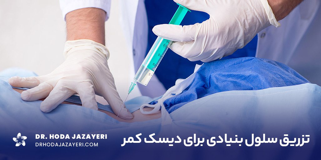 تزریق سلول بنیادی به دیسک کمر