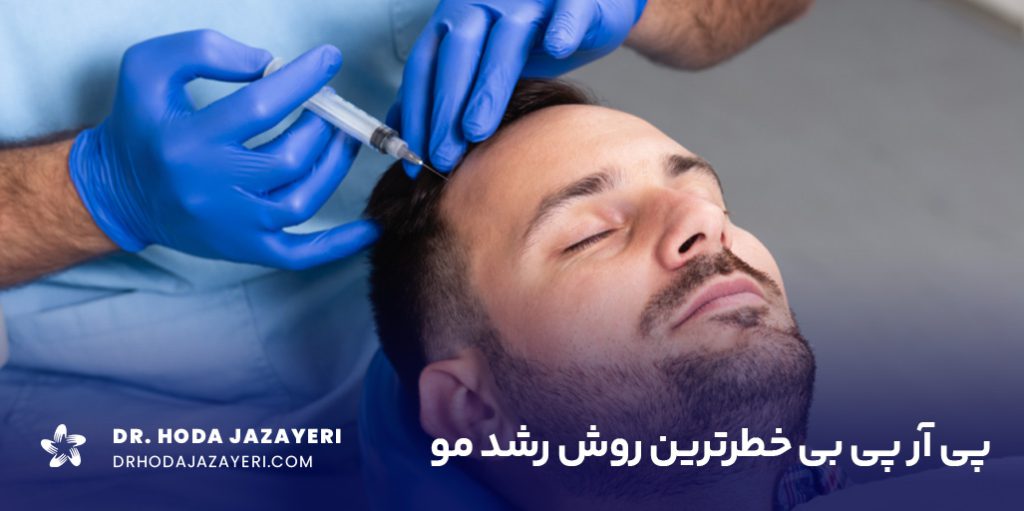 پی آر پی مو