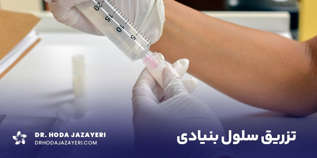 تزریق سلول بنیادی