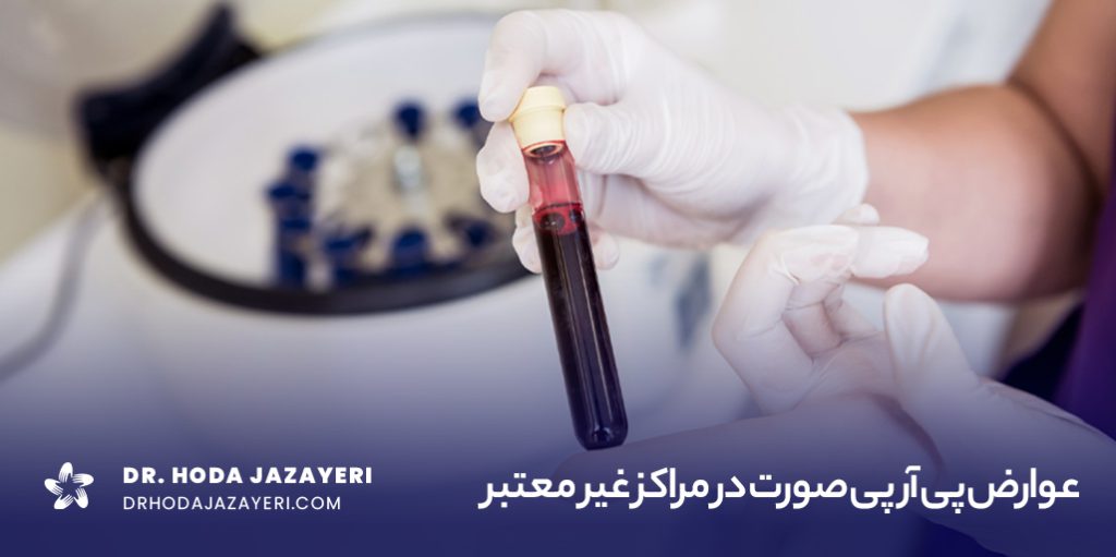 عوارض پی آر پی صورت