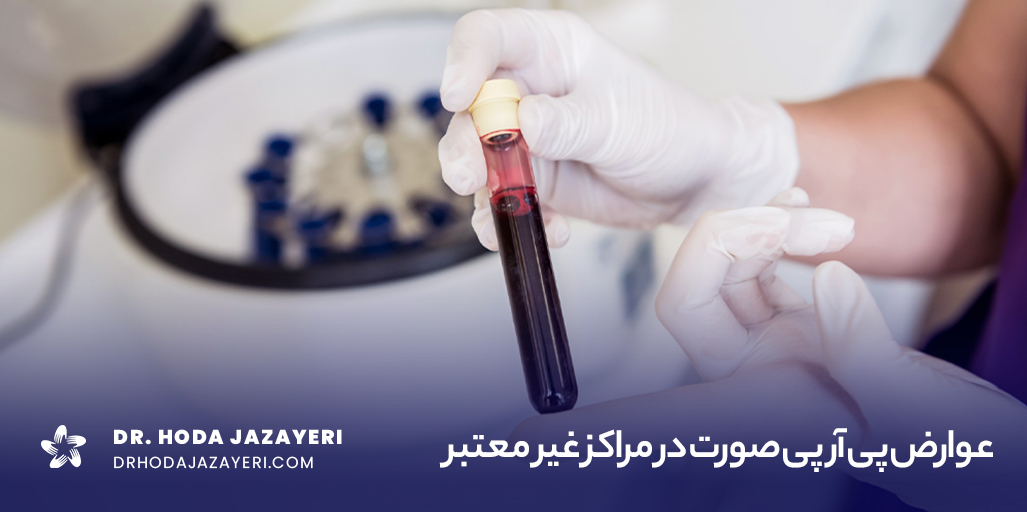 عوارض پی آر پی صورت