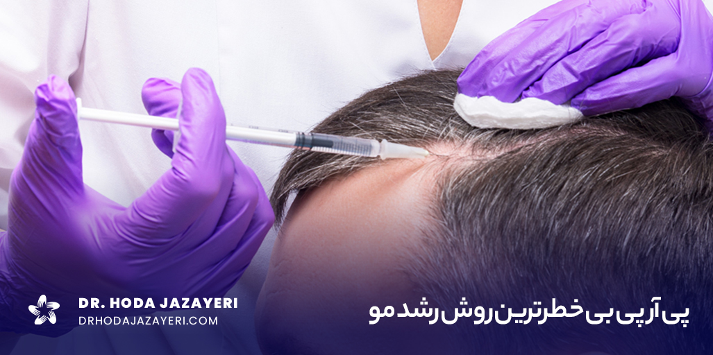 پی آر پی یا مزوتراپی؟