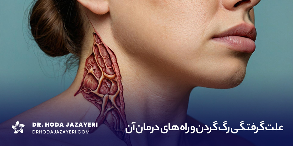 گرفتگی رگ گردن می‌تواند باعث درد شدید و محدودیت در حرکت گردن شود که نیاز به درمان فوری و استراحت دارد.