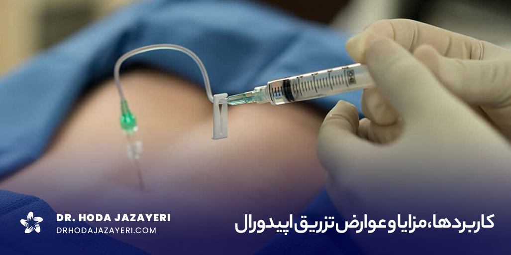 عوارض تزریق اپیدورال در کمر ممکن است شامل درد در محل تزریق، عفونت، خونریزی و آسیب به نخاع باشد.