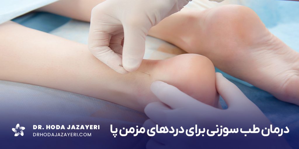 طب سوزنی برای پا درد یک روش نوین است که کمک میکند، دردهای شما کاهش پیدا کند.