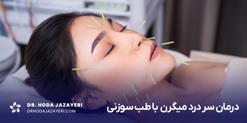 طب سوزنی برای میگرن یک روش غیر تهاجمی و کاملا تضمین شده است.