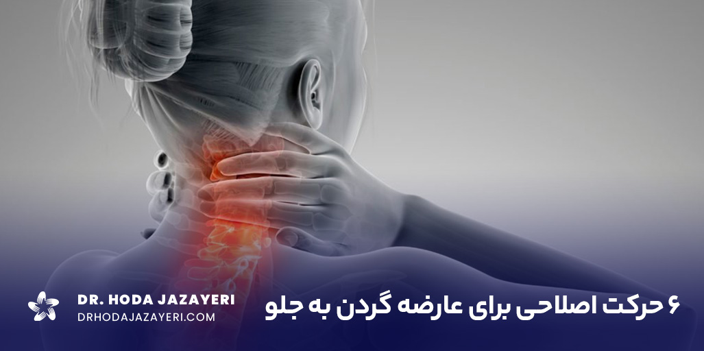 معرفی بهترین حرکات اصلاحی گردن جلو آمده