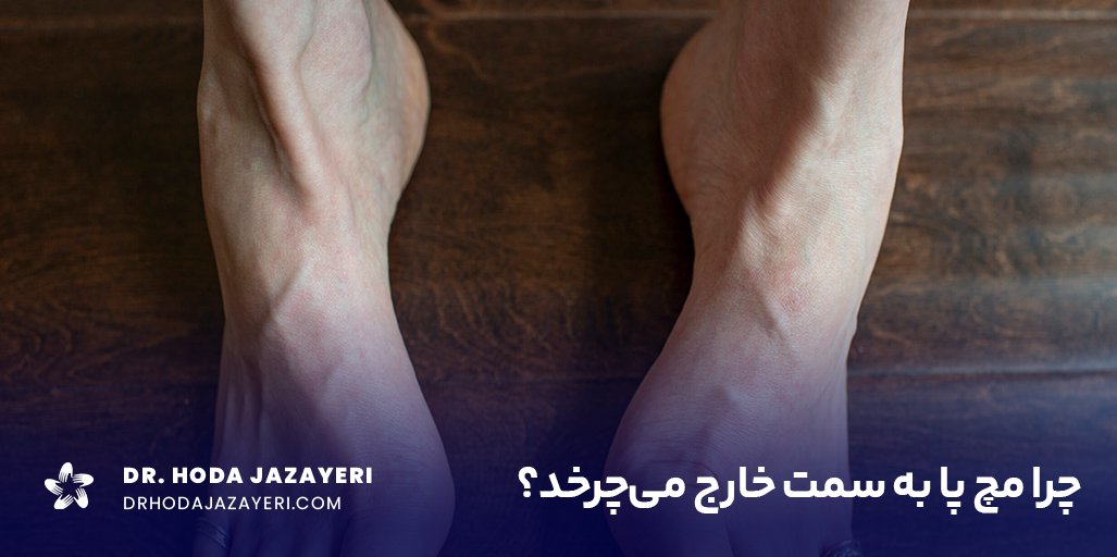 چرخش مچ پا به خارج با درد همراه است؟