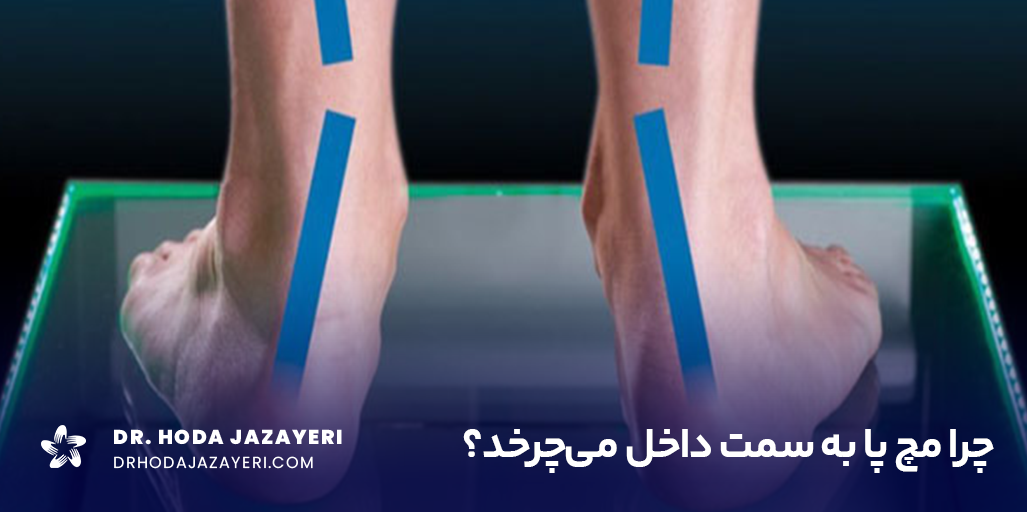 چرخش مچ پا به داخل چطور اتفاق می افتد؟
