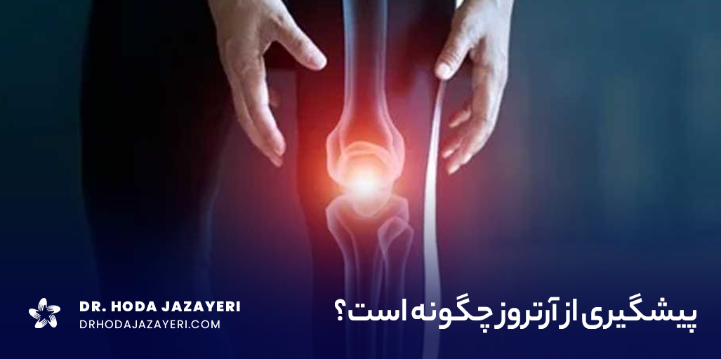 جلوگیری از پیشرفت آرتروز با ورزش و سلامتی