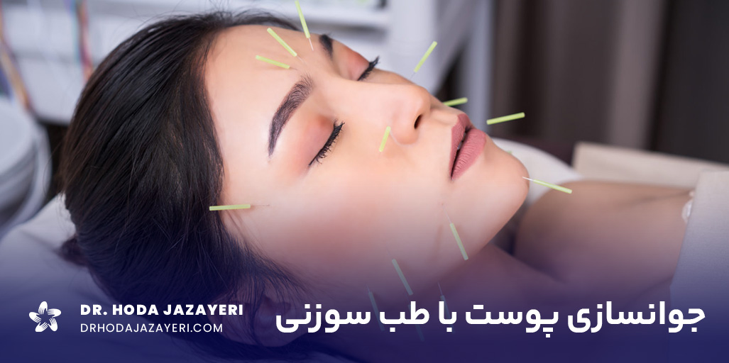 طب سوزنی صورت و تاثیرات شگرف آن