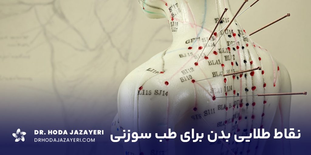 مهم ترین نقاط طب سوزنی در بدن