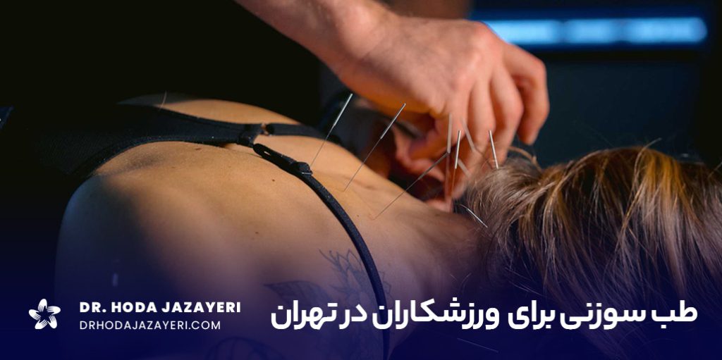 طب سوزنی ورزشکاران در تهران